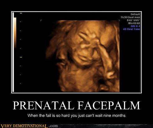 prenatal facepalm